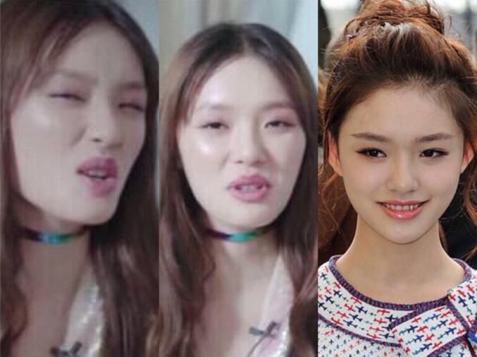 盘点女明星整容事件，最蠢的是为爱整容