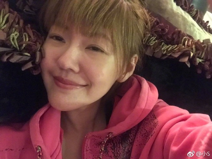 小s自曝脸上的肉毒杆菌和玻尿酸快消失了，她为此感到开心