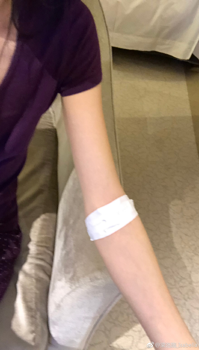 梁洛施生病暴瘦吓坏网友，大臂比小臂还要细！