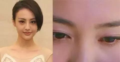 瞎整派掌门人杨紫终于翻身了，这个部位整得一雪前耻！