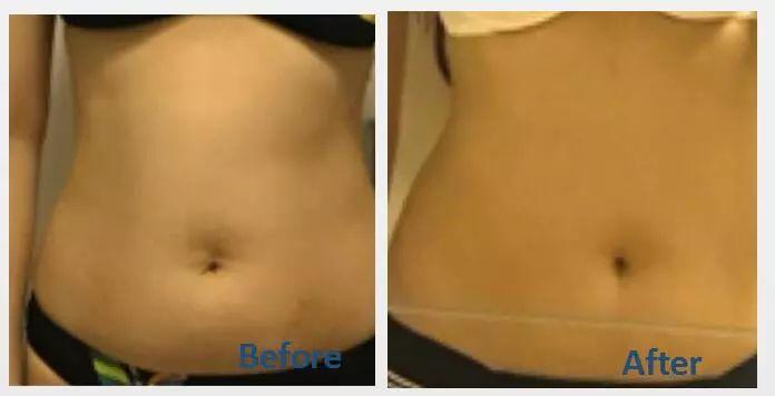 睡前练一次, 整夜燃脂 , 女人“大肚子”慢慢变平