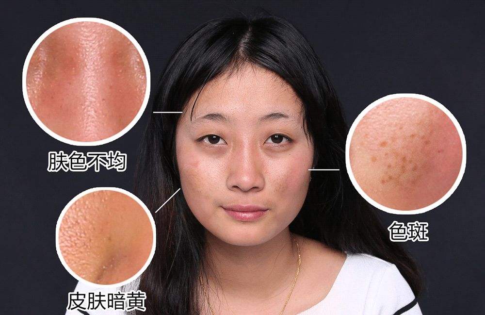 面色蜡黄还长黄褐斑?你可能是内分泌失调了,3个方法调理好