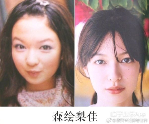 她这下巴是不是整失败了？