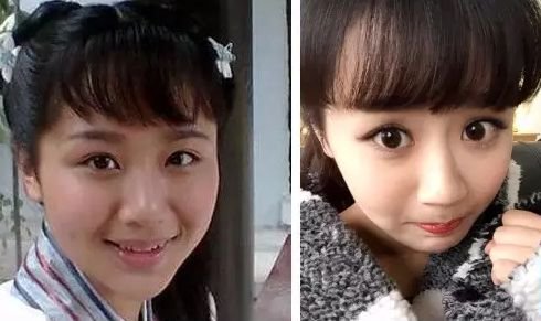 苏有朋把自己整成林峯！为什么男人这么爱动下巴？！