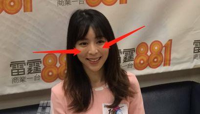 林允儿的神颜也崩了！脸歪+填充成气球，这两道沟又是什么鬼？