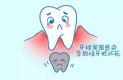 恒牙胚坏死.jpg