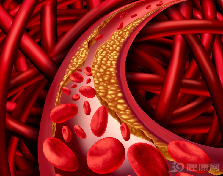 误诊率高！心血管梅毒是什么病？它有哪些典型症状？