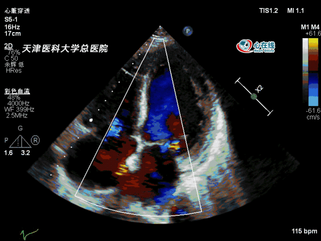 心动在线丨令人后怕的