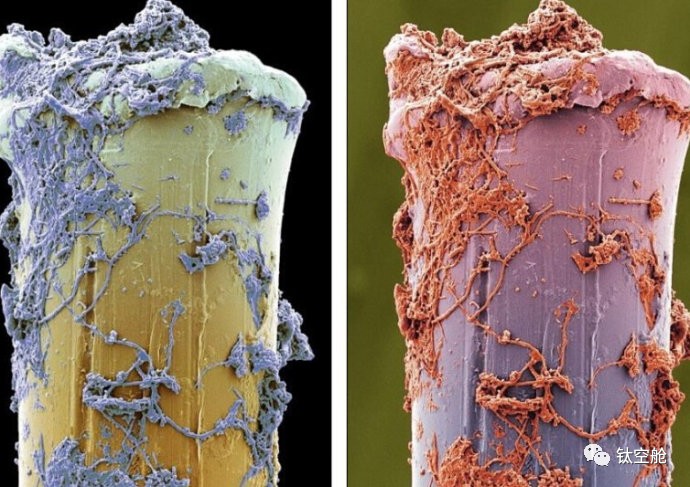 每天用的牙刷竟然有上百万细菌......怎么办？