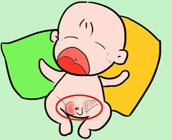 小儿疝气不治疗可能损伤孩子以后生育能力