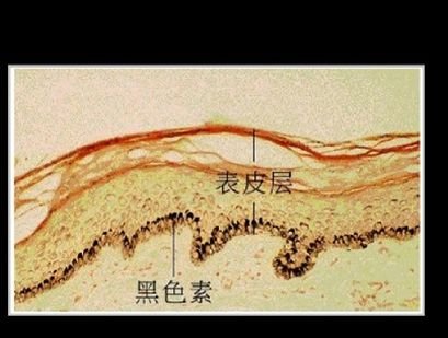 张韶涵在抗衰大战中完胜，可她推荐的这种“黑科技”就是智商税