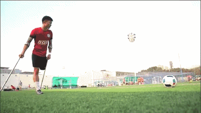 经历三次截肢手术也不放弃足球梦,“独腿球王”何忆义的励志人生