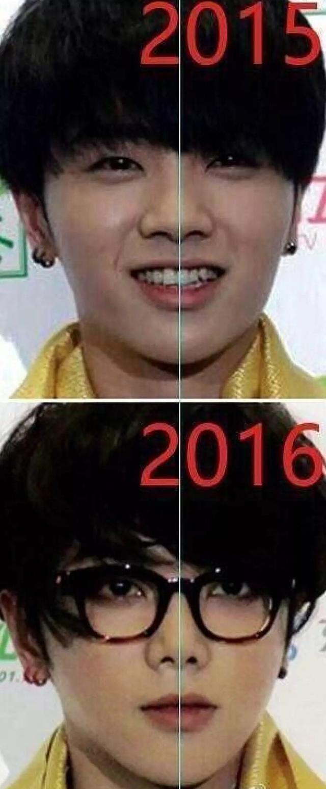 华晨宇一年一个样,整容上瘾了?