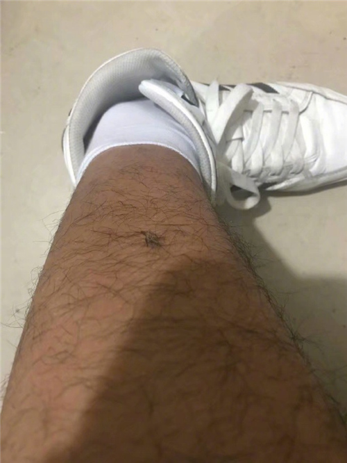 每日神段子腿毛多其实是一件好事