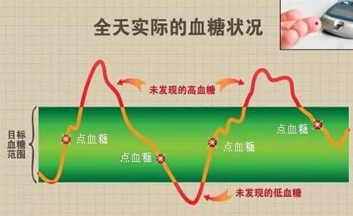 怎么算高血糖 003A80B1121EFD43A27063871826F5A54AC5A3BD_size23_w497_h304.jpeg
