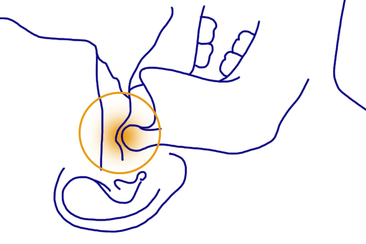 18岁的王源彩排时痛到捂脸，专家研究发现50%的人都有这个问题！