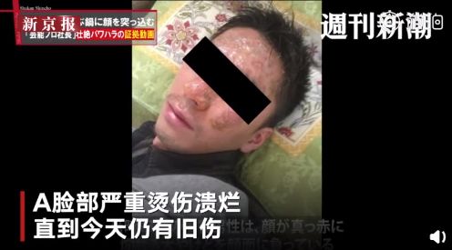 “我的头被人按进了火锅里”