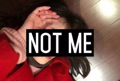 马蓉伤照被指摆拍，后被友人背着跑出院，网友：那我们来P图吧！