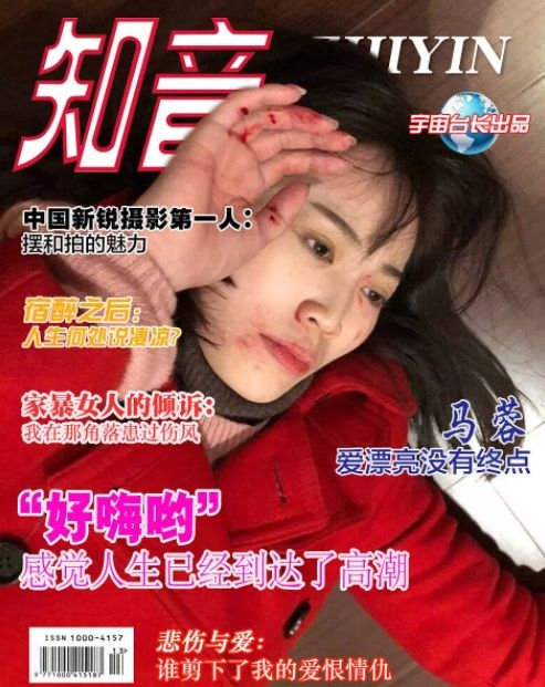 马蓉伤照被指摆拍，后被友人背着跑出院，网友：那我们来P图吧！
