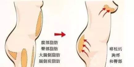 回春没多久的杨紫，咋又肿成这样了？