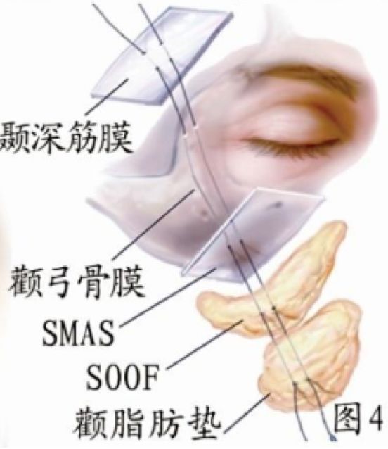 好气哦！那么美的热巴，却被脸上这块肉肉毁了颜值！