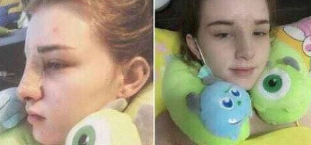 绝美混血颜少女竟因太美遭群攻！然而她从脸到胸到腿都是整出来的…