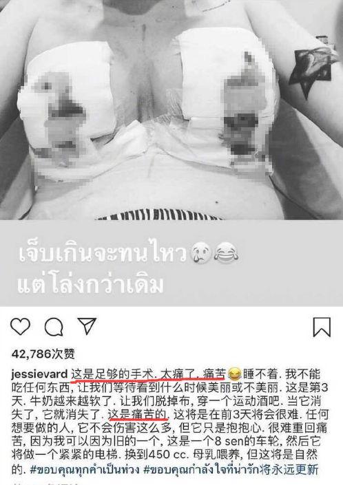 这个19岁网红，po出了自己整容的全过程