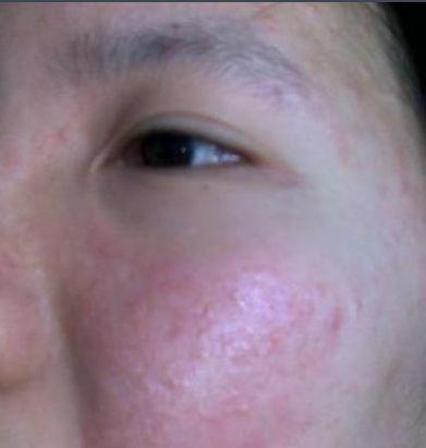 什么都不怕的韩雪，遇到这种事也没辙了