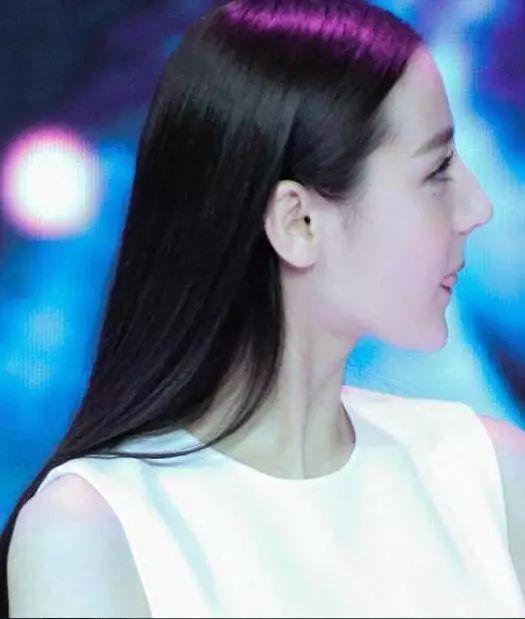 12岁整鼻到20岁还没拆绷带，只是为了炫富？