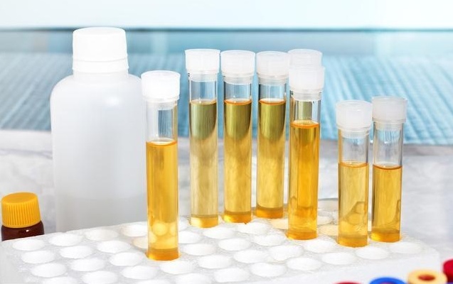 喝什么降低尿蛋白 9AF5427BBD82EF361CE82362C1F89D197B3E60AE_size64_w637_h400.jpeg