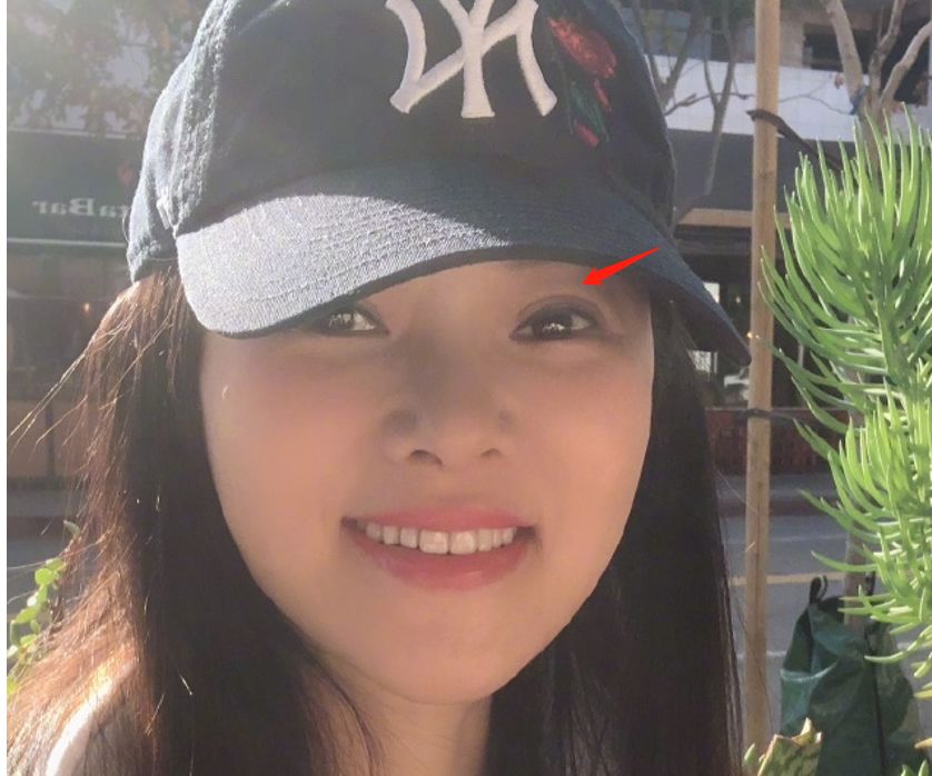 瞎整派掌门人杨紫终于翻身了，这个部位整得一雪前耻！