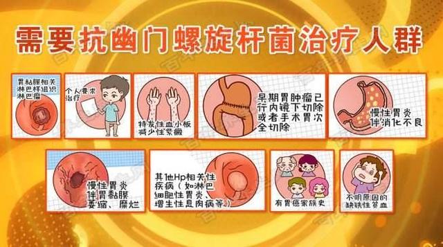 四联疗法治疗幽门螺旋杆菌,四种药应该如何吃,医生为您解惑