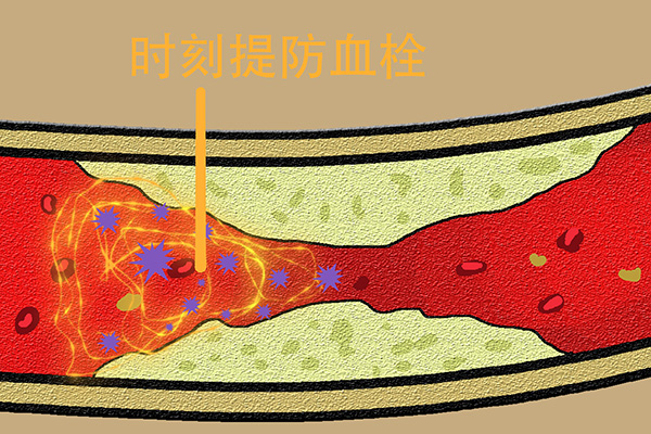 血栓是怎样形成的做对简单的小动作或能让血栓不再栓住你