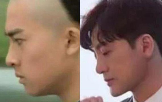 苏有朋把自己整成林峯！为什么男人这么爱动下巴？！