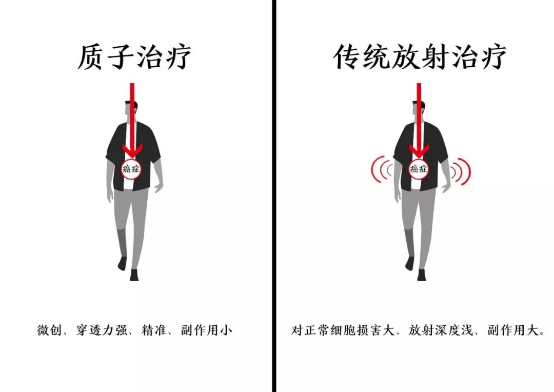 华西院长：最先进的癌症治疗中心 落户成都