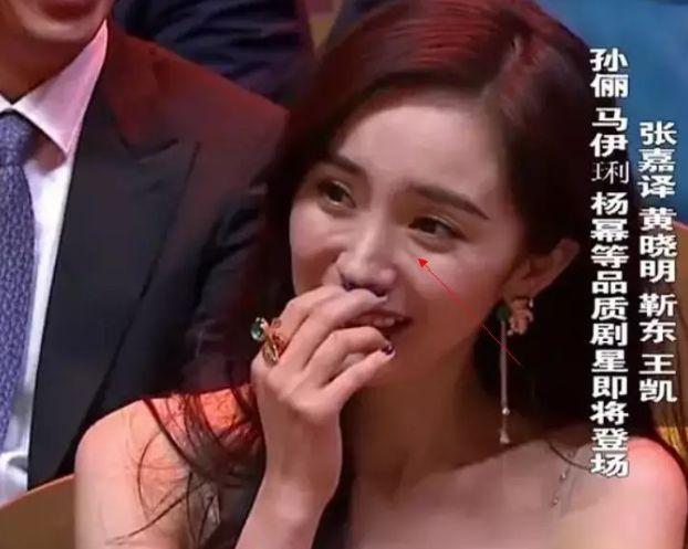 林允儿的神颜也崩了！脸歪+填充成气球，这两道沟又是什么鬼？