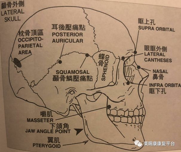 (颅骨侧面压痛点)