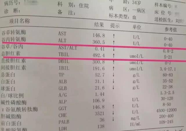 34岁小伙患上肝硬化,他该怎样维护保养和科学饮食呢?