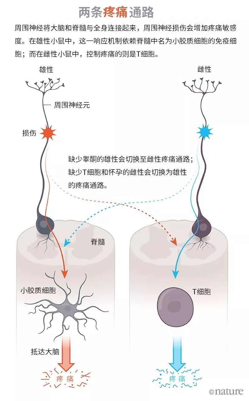 痛的领悟:不同性别疼痛通路存在差异