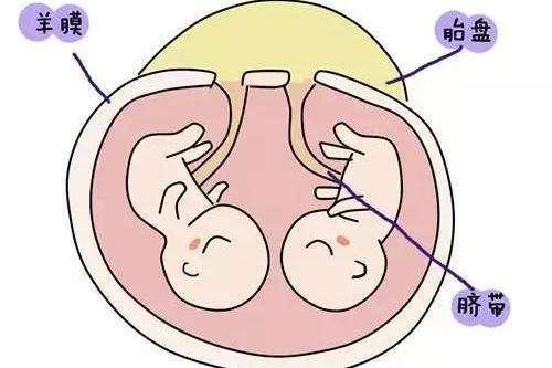 1岁双胞胎长得不像,宝爸坚持做亲子鉴定,结果出来后愧疚不已!