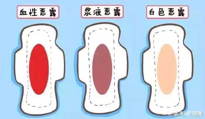 光神巴德尔:你生完孩子后,恶露排了多久?恶露藏着妈妈
