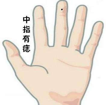 手腕胳膊上痣诸多的含义，位置不同人生事业，前途感情截然不同
