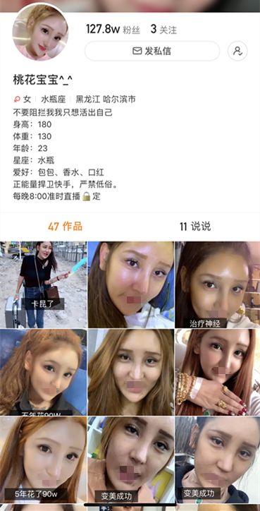 网红桃花宝宝多次整容导致鼻组织坏死直播融玻尿酸脸要爆炸了