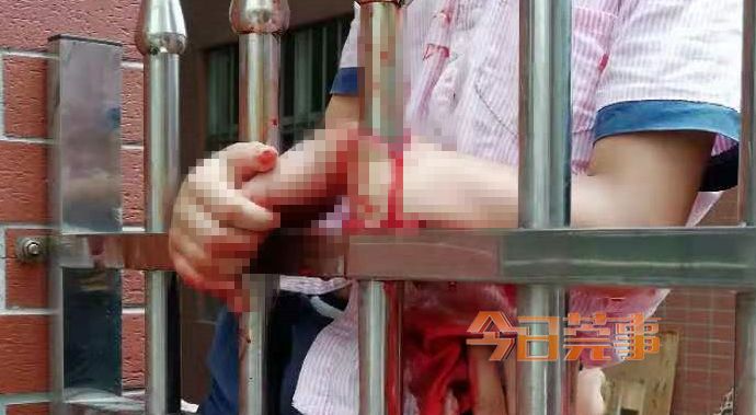 太恐怖了!东莞8岁男孩手臂被护栏尖头刺穿!现场血流一地… 澳门新世纪娱乐场