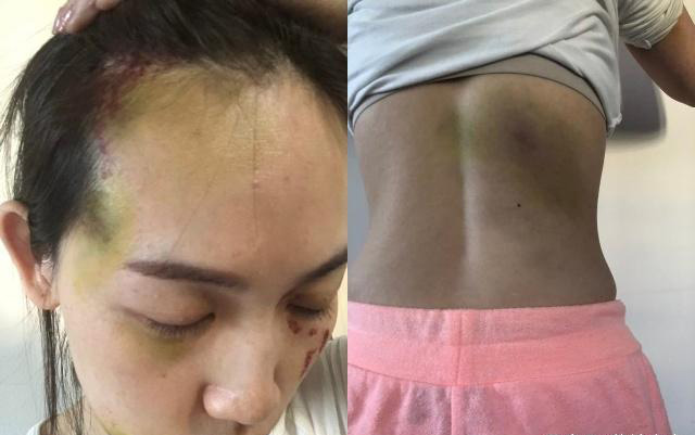 马蓉被打近照曝光,曝出王宝强与现女友孩子三岁多,四年前已出轨__凤凰