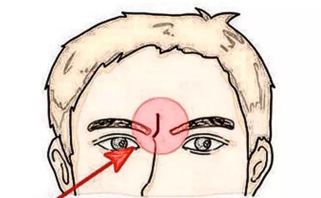 印堂位置,竖直的一条,像一根针一样选在印堂之上,在面相中又称斩子纹