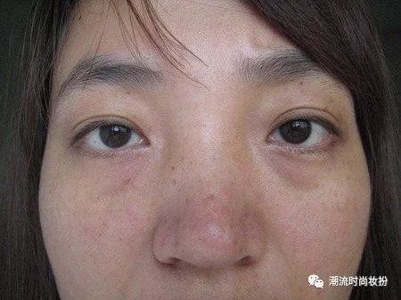 每天用它敷一敷,十五天祛除斑点不是梦