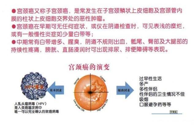 宫颈癌是什么原因引起的