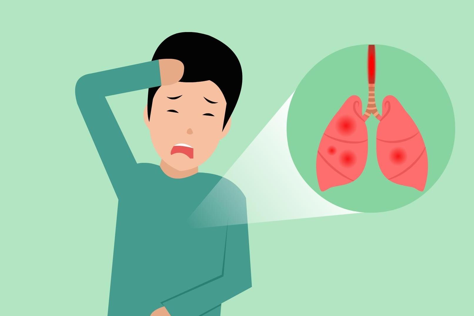 慢性支气管炎患者一定会得肺心病?慢性支气管炎是肺心病的第一步