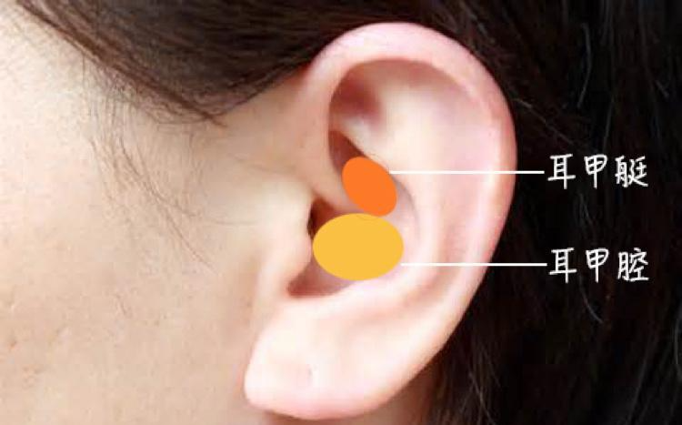 耳甲腔癌图片